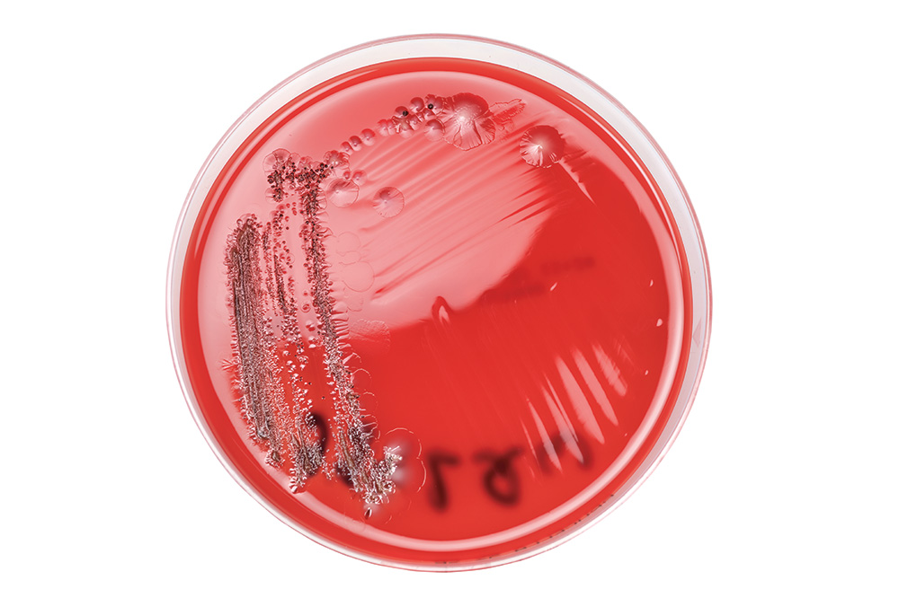 世界の辺境で腸内細菌を集める
